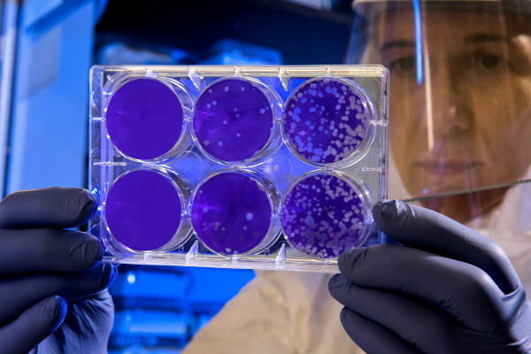 Person in laboratory looking at petri dish