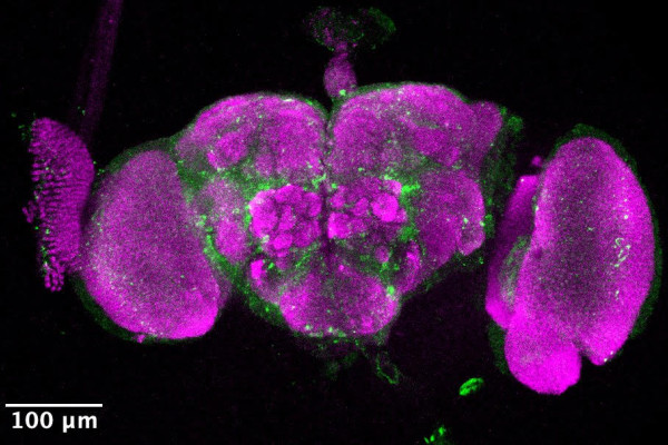 Wolbachia infected female fruit fly brain