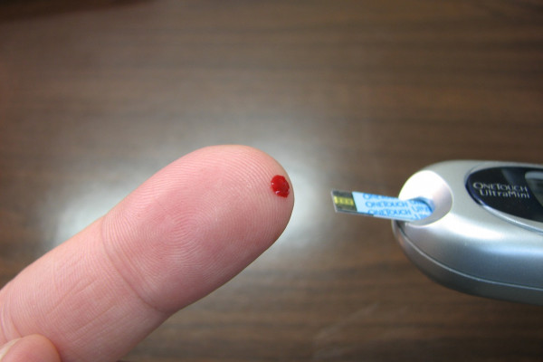 a photo of finger prick blood test for blood glucose monitoring