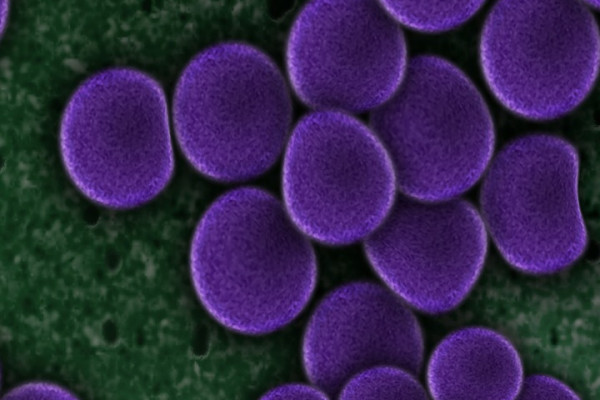purple bacteria cells on a green background