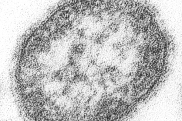 A measles virus particle (virion). The measles virus is a paramyxovirus, of the genus Morbillivirus. It is 100-200 nm in diameter, with a core of single-stranded RNA, and is closely related to the rinderpest and canine distemper viruses.
