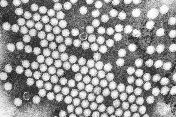 Electron micrograph of the poliovirus. Poliovirus is a species of Enterovirus, which is a Genus in the family of Picornaviridae, and is an RNA virus.