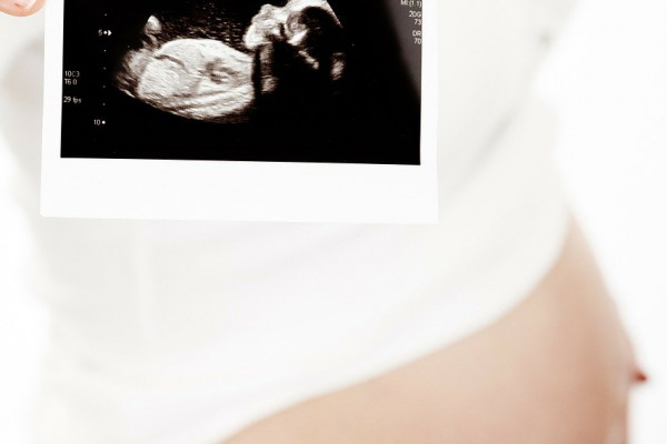 ultrasound image of baby in womb