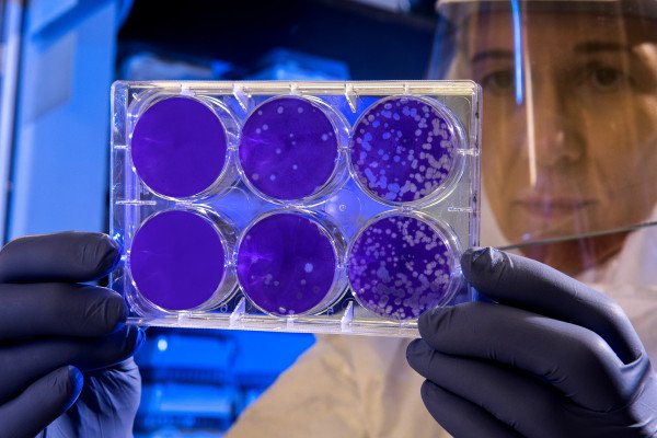 A scientist examining samples of bacteria growing on petri dishes.