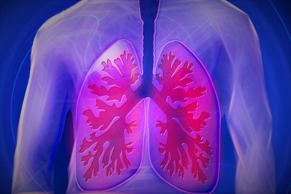 CGI Lungs
