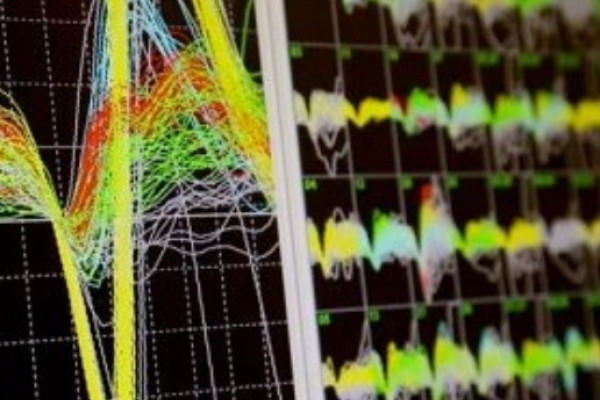 Brain signals from the motor cortex of a monkey implanted with electrodes.