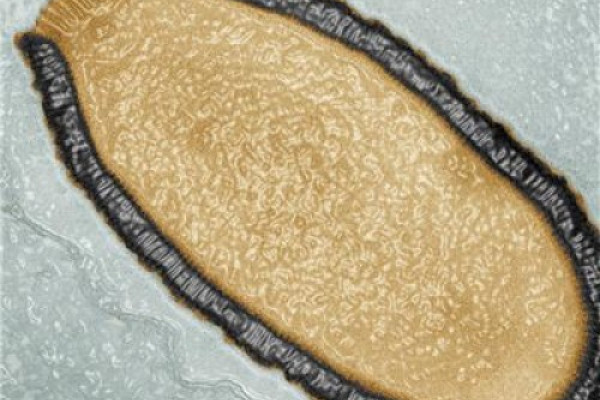  Transmission electron microscopy color image of a Pithovirus sibericum cross-section. This virion, dating back more than 30,000 years, is 1.5 µm long and 0.5 µm wide, which makes it the largest virus ever discovered. © Julia Bartoli & Chantal...