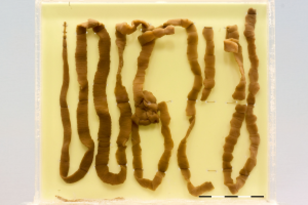 Tapeworm (Taenia species)