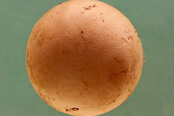 Ball thrombus