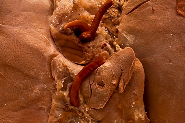 Ascaris lumbricoides (Liver)