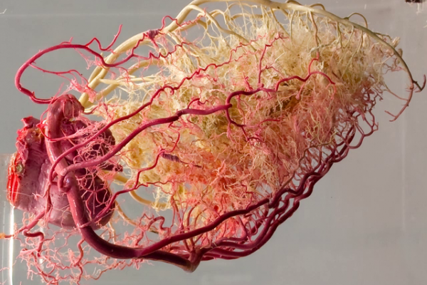Coronary arteries III (resin cast)