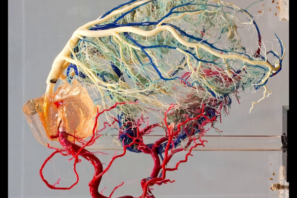 Normal cardiac venous system