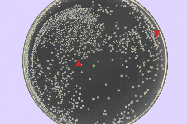 Radiation Resitant E. coli