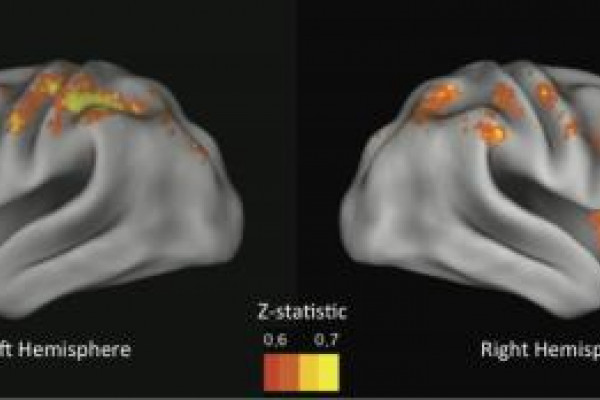 When these brain regions (mostly associated with control) aren't active enough, we make risky choices. Z-statistic corresponds to predictive ability, yellow being the most predictive regions.