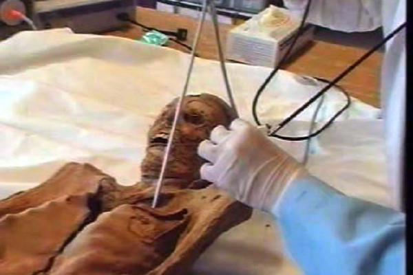 sampling a mummy