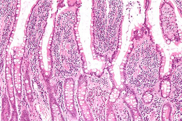 Low magnification micrograph of small intestinal mucosa. H&E stain.