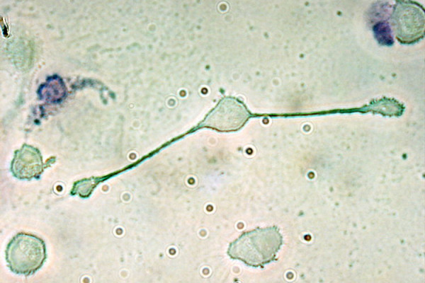 A macrophage of a mouse forming two processes to phagocytize two smaller particles, possibly pathogens