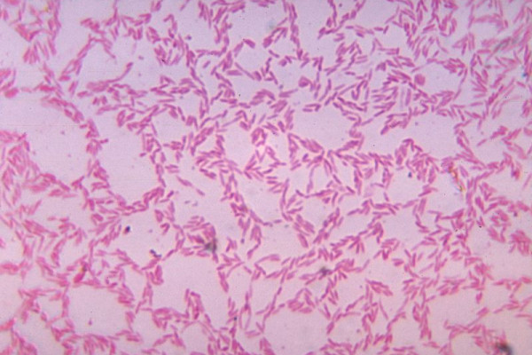 Bacteroides biacutis  one of many commensal anaerobic Bacteroides spp. in the gastrointestinal tract  cultured in blood agar medium for 48 hours.