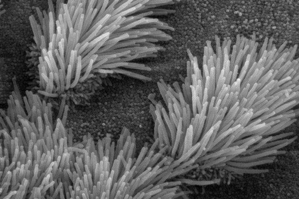 Scanning electron microscope image of lung trachea epithelium. There are both ciliated and on-ciliated cells in this epithelium. Note the difference in size between the cilia and the microvilli(on non-ciliated cell surface)