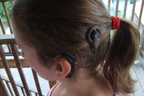 A cochlear implant as worn by the user