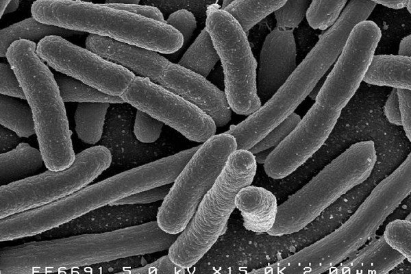 Escherichia coli: Scanning electron micrograph of Escherichia coli, grown in culture and adhered to a cover slip.