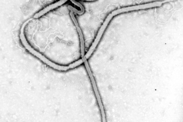 Ebola virus, as seen under an electron microscope. Ebola is a member of the filovirus family. The tubular \shepherd's crook\-shaped particles are generally 80nm in diameter and up to 1000nm long.