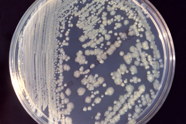 Colonies of Enterobacter cloacae bacteria on Tryptic Soy Broth agar plate. Obtained from the CDC Public Health Image Library; image credit: CDC(PHIL #6552), 1983.