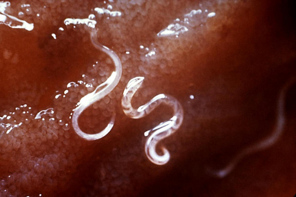 ''Ancylostoma caninum'', a type of hookworm, attached to the intestinal mucosa. Hookworms are blood-sucking nematodes that feed on blood. Heavy infections can cause anaemia due to loss of blood.