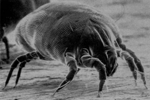 Dermatophagoides pteronyssinus - North American House Dust Mite, a major creator of allergens