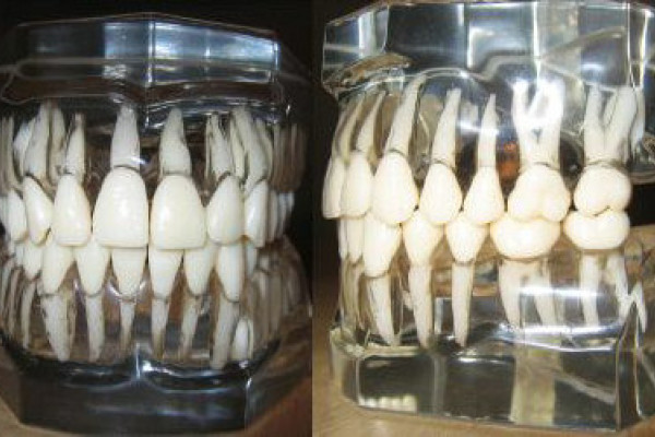 Models of human teeth as they exist within the alveolar bone.