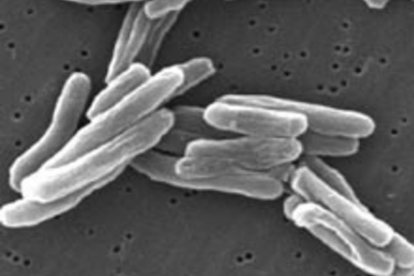Mycobacterium tuberculosis (TB) bacteria seen under scanning electron microscope (x15000)
