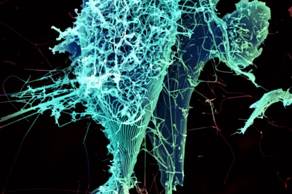 String-like Ebola virus particles are shedding from an infected cell in this electron micrograph