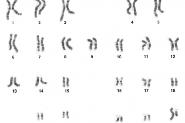 Karyotype of a human male - showing all 23 pairs of chromosomes that make up the human genome. Not the 'XY' sex chromosomes, showing this person is male.