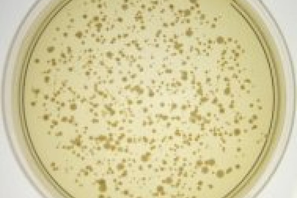 Bacterial culture as sampled from from a toilet seat