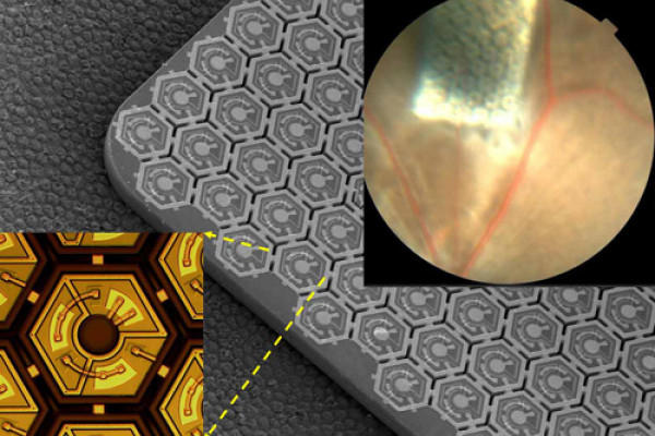  This pinpoint-sized photovoltaic chip (upper right corner) is implanted under the retina in a blind rat to restore sight. The center image shows how the chip is comprised of an array of photodiodes, which can be activated by pulsed near-infrared...