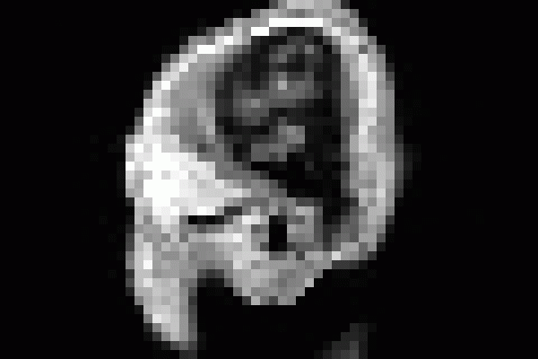 An animated gif of MRI images of a human head (smaller)