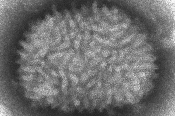 Vaccinia, a pox virus particle.