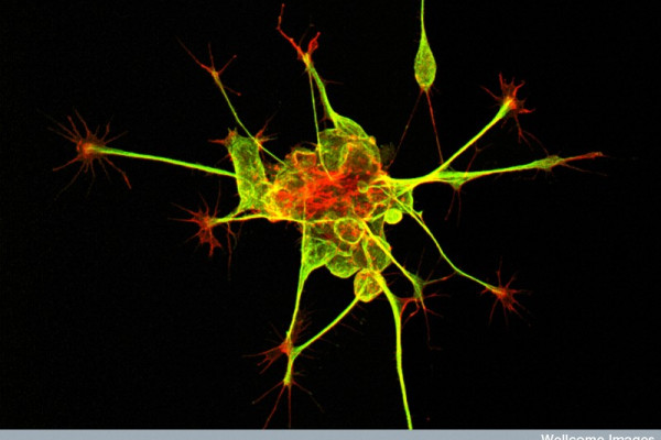 New Nerve Cells