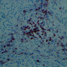 An infiltration of T cells, shown by dark brown colour, can be seen in the tissues formed by iPSCs.