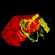 3D tissue imaging