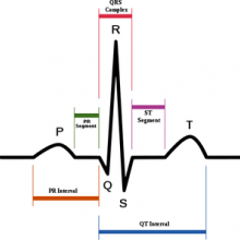 Schematic diagram of normal sinus rhythm for a human heart as seen on ECG (with English labels).