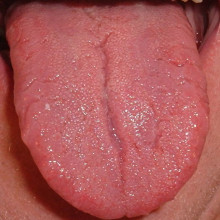 Human Tongue