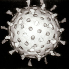 Computer assisted reconstruction of a rotavirus particle