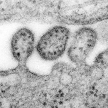  Highly magnified transmission electron micrograph (TEM) depicted some of the ultrastructural details of a number of Lassa virus virions adjacent to some cell debris. The virus, a member of the virus family Arenaviridae, is a single-stranded RNA...