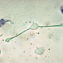 A macrophage of a mouse forming two processes to phagocytize two smaller particles, possibly pathogens