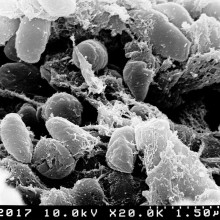 Scanning electron micrograph depicting a mass of Yersinia pestis bacteria (the cause of bubonic plague) in the foregut of the flea vector