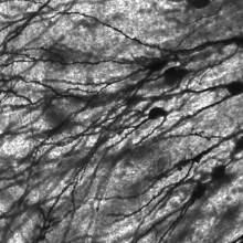 Image of Golgi stained neurons in the dentate gyrus of an epilepsy patient. 40 times magnification.