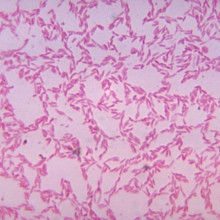 Bacteroides biacutis  one of many commensal anaerobic Bacteroides spp. in the gastrointestinal tract  cultured in blood agar medium for 48 hours.