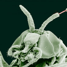 Adult Black Fly (Simulium yahense) with (Onchocerca volvulus) emerging from the insect's antenna. The parasite is responsible for the disease known as River Blindness in Africa. Sample was chemically fixed and critical point dried, then observed...