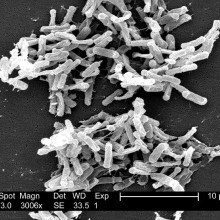 Clostridium difficile (C.diff) microbes seen under the electron microscope